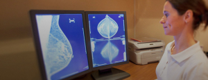 Mammogram Procedure Code | Medical Imaging Software eRAD